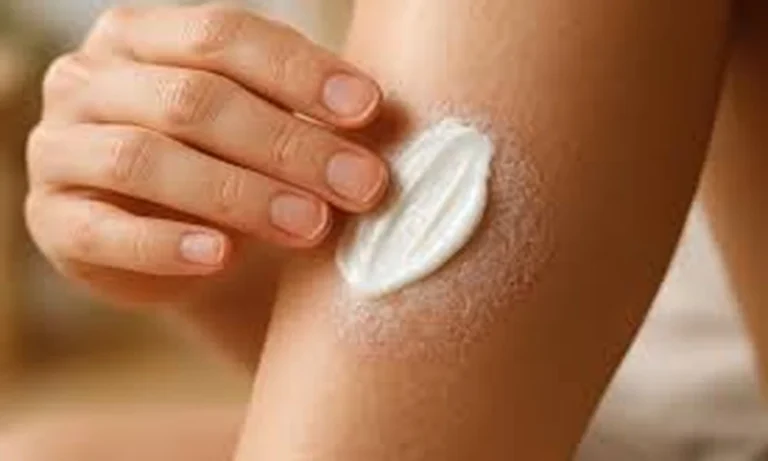 Guide for Choosing the Right Eczema Cream for Your Skin